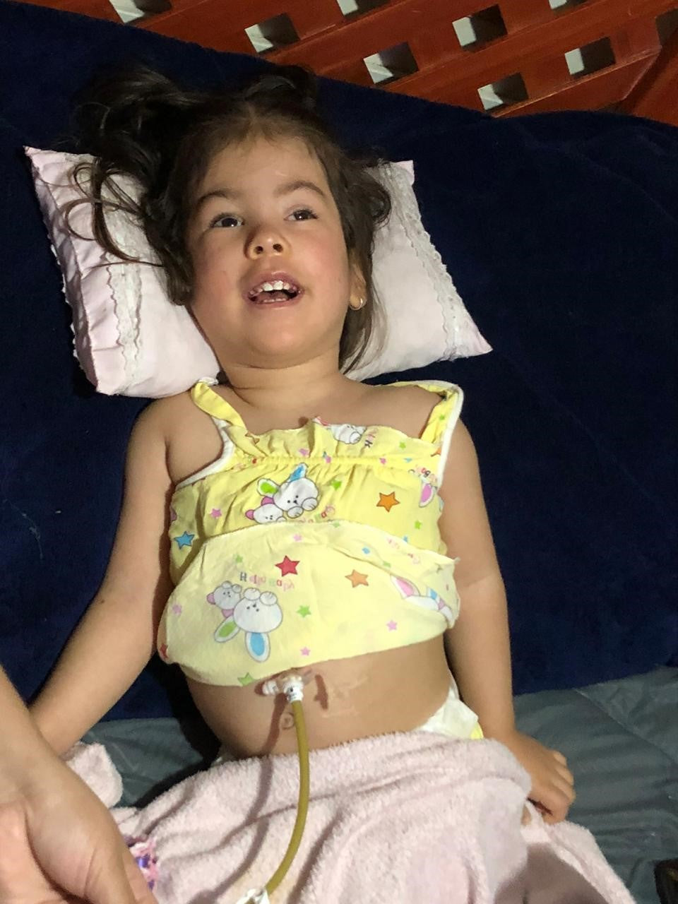 Antonella tiene 2 años y nació con enfermedades como esquizencefalia, hidrocefalia, epilepsia