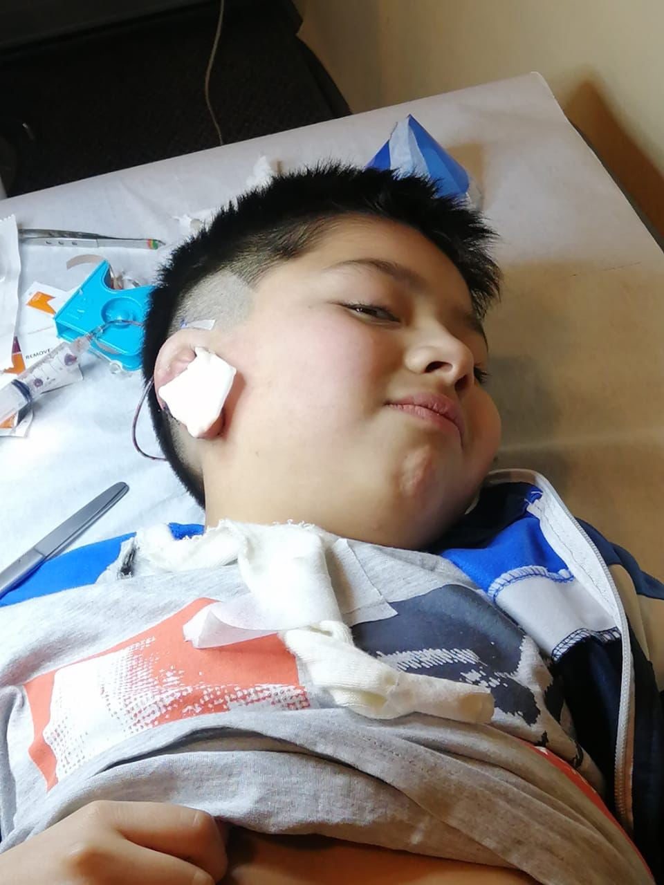 Matías tiene 8 años y nació con microtia, una malformación congénita que afecta su audición