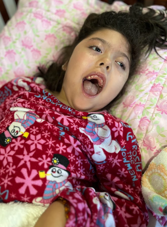 Sofi, una niña con epilepsia refractaria y parálisis cerebral severa